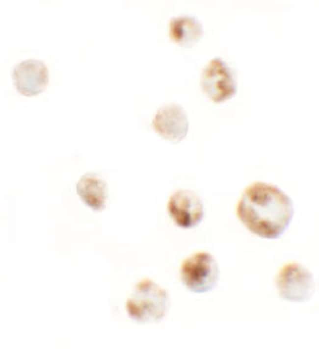 0.1MG AFAP1L1 0.1 MG