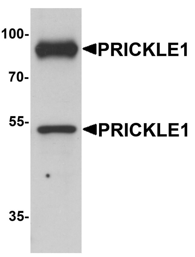 0.1MG PRICKLE1 0.1 MG