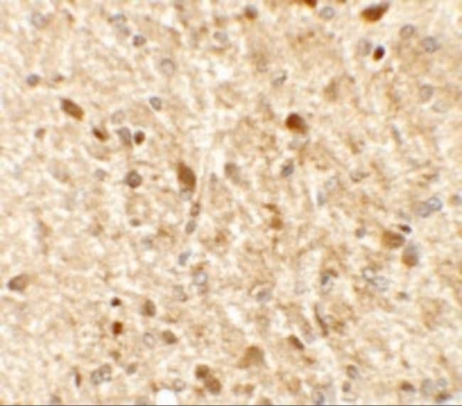 0.1MG MS4A6A 0.1 MG