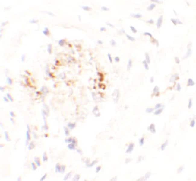 0.1MG LEMD3 0.1 MG