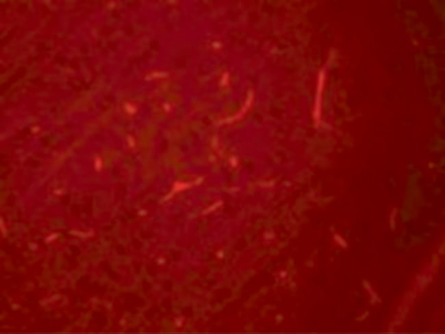 0.1MG SIK3 0.1 MG