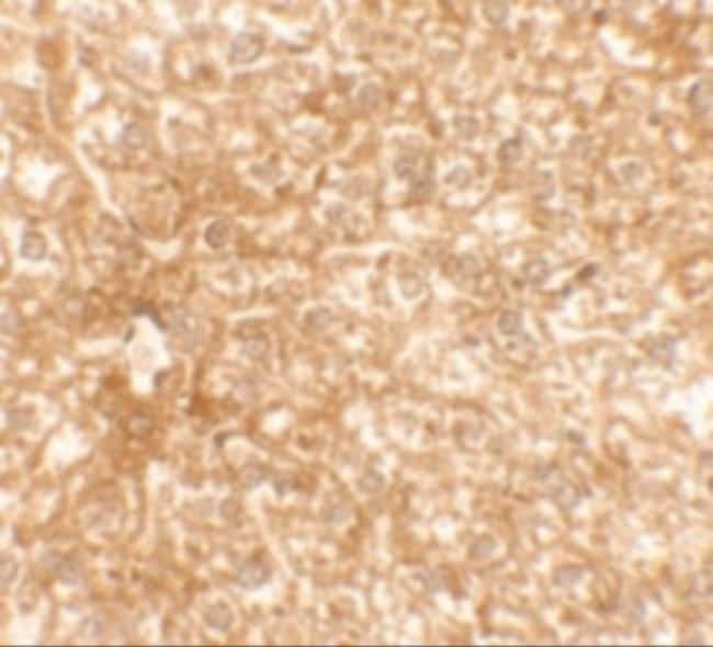 0.1MG RAPGEF4 0.1 MG