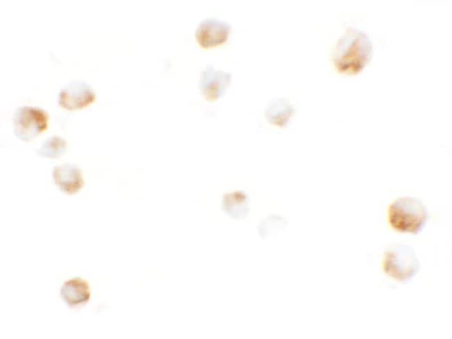 0.1MG KPNA5 0.1 MG