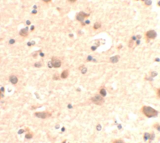 0.1MG RUSC2 0.1 MG