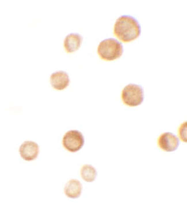 0.1MG CASKIN2 0.1 MG