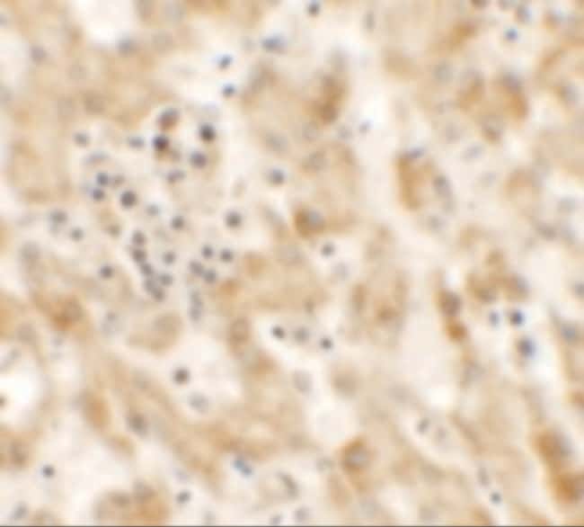 0.1MG NKX2.8 0.1 MG