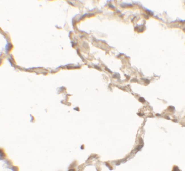 0.1MG DOPA DECARBOXYLASE 0.1 MG