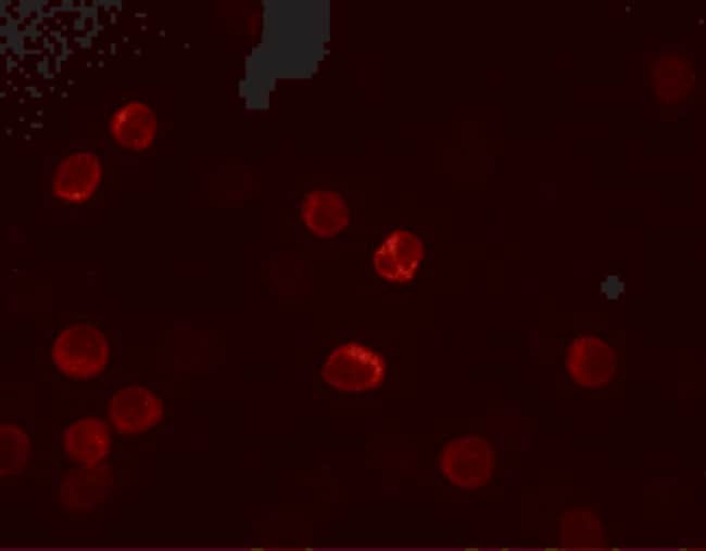 0.1MG IL-28B 0.1 MG