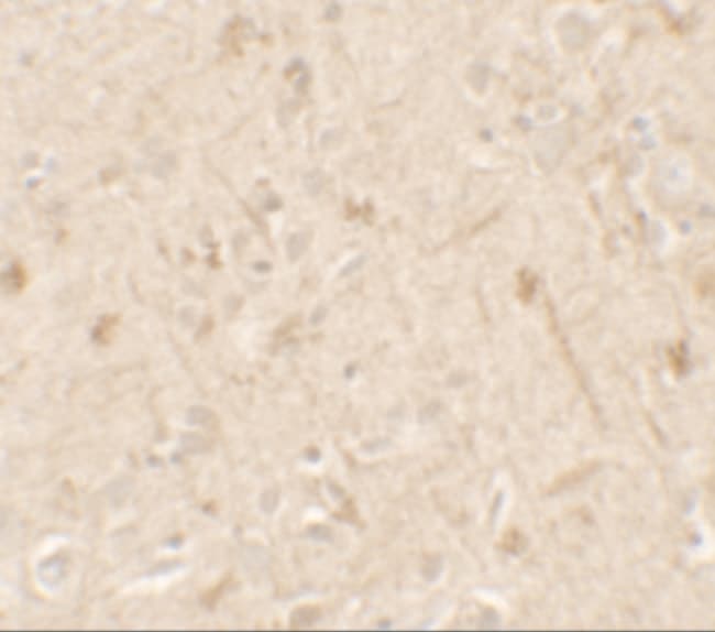 0.1MG IL1F6 0.1 MG