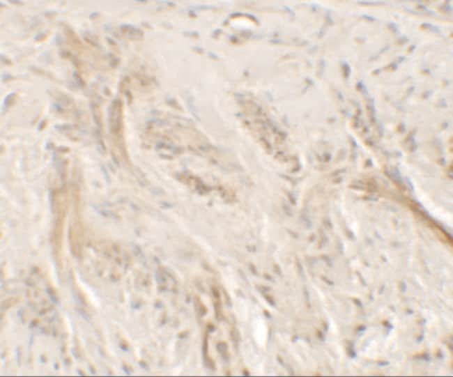 0.1MG IL1F9 0.1 MG