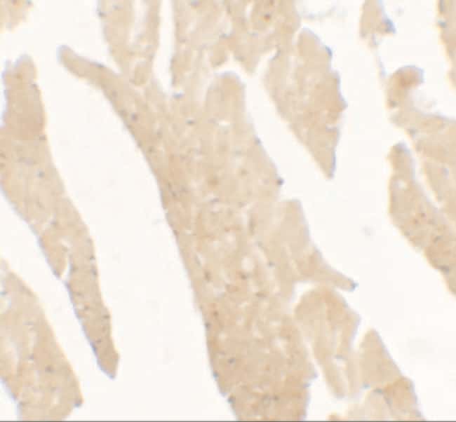 0.1MG IL1F5 0.1 MG