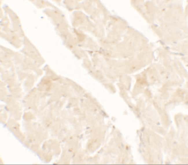 0.1MG JTV-1 0.1 MG