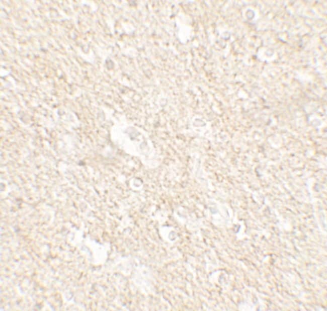 0.1MG PAT1 0.1 MG