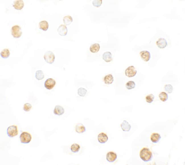 0.1MG DNM1L 0.1 MG