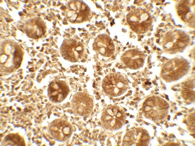 0.1MG APOBEC3B 0.1 MG