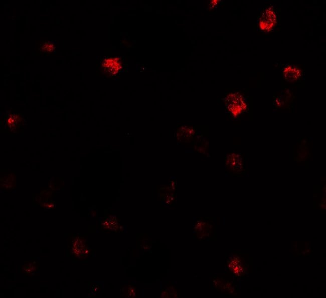 0.1MG NDST2 0.1 MG