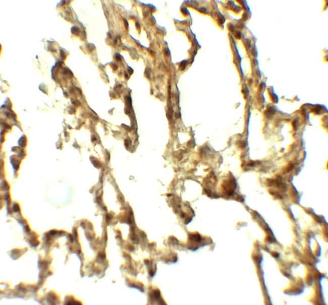 0.1MG ATG4C 0.1 MG