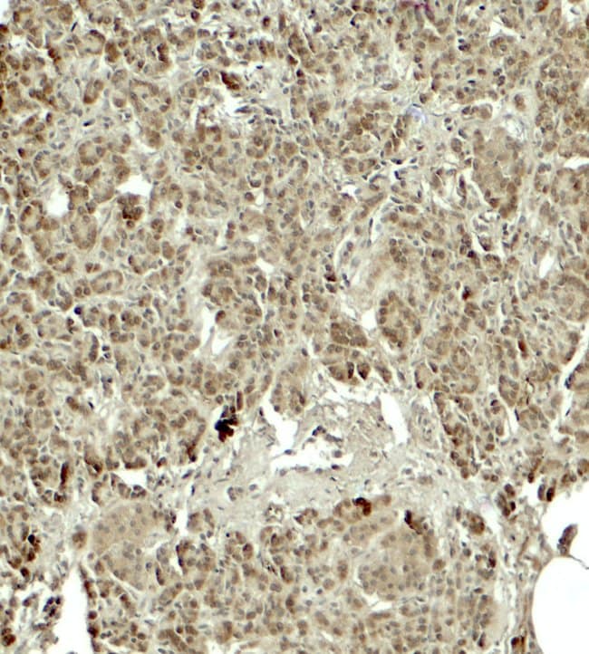 0.1MG KIRREL2 0.1 MG
