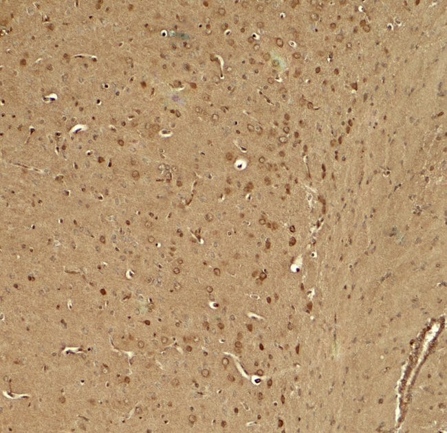 0.1MG KCNK1 0.1 MG