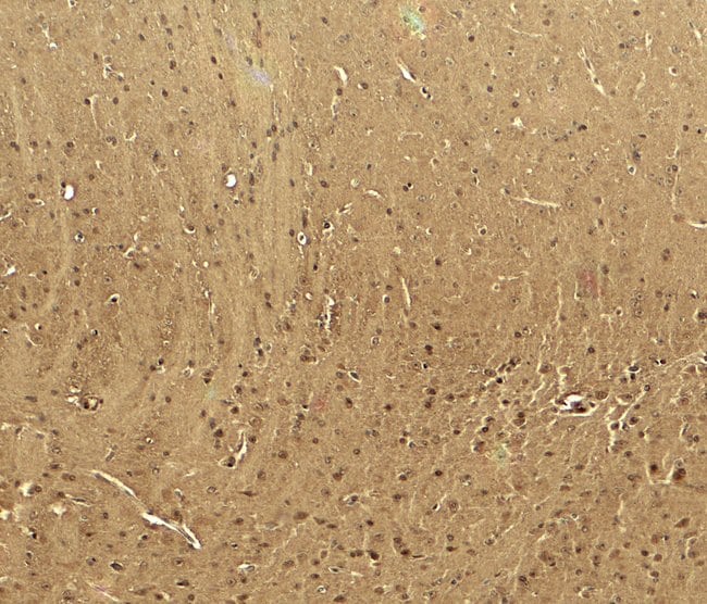 0.1MG CALCIUM CHANNEL 1H 0.1 MG