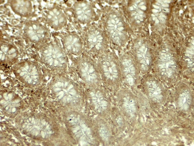 0.1MG EPLIN 0.1 MG