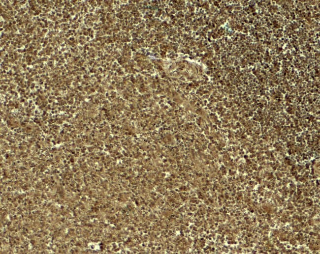 0.1MG JAGGED1 0.1 MG