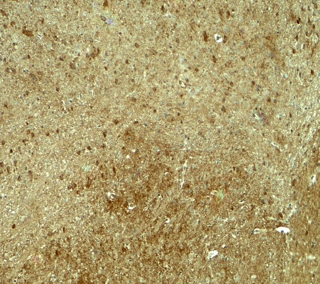 0.1MG PJA 0.1 MG