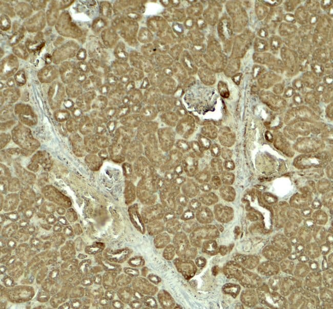 0.1MG SLC1A7 0.1 MG