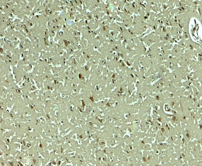 0.1MG PMAT 0.1 MG