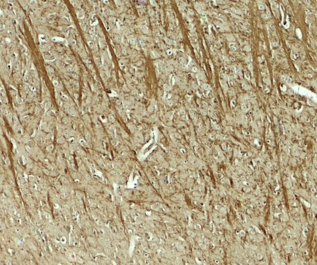 0.1MG TENM3 0.1 MG