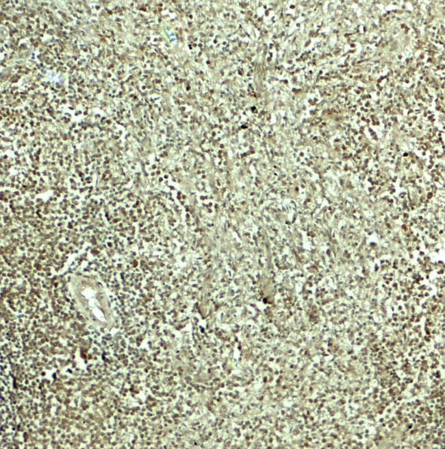 0.1MG SNRPN 0.1 MG