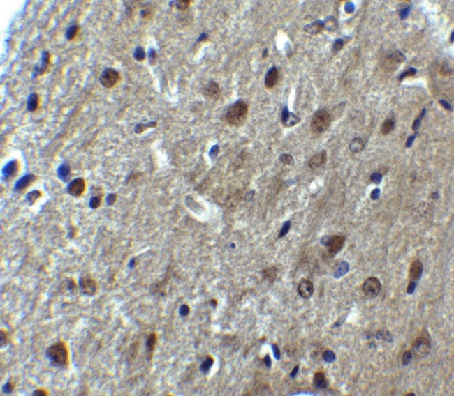 0.1MG ARID1A 0.1 MG