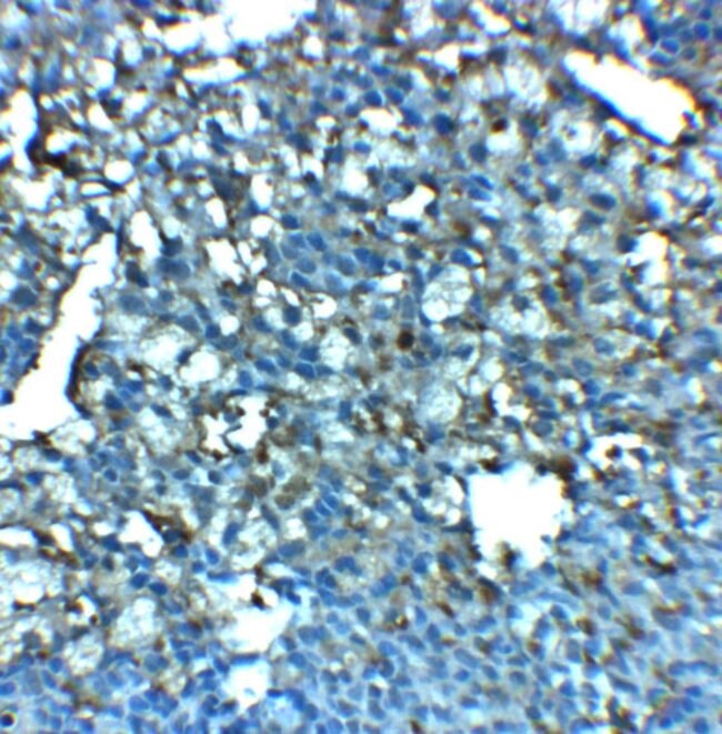 0.1MG LRRC8A 0.1 MG