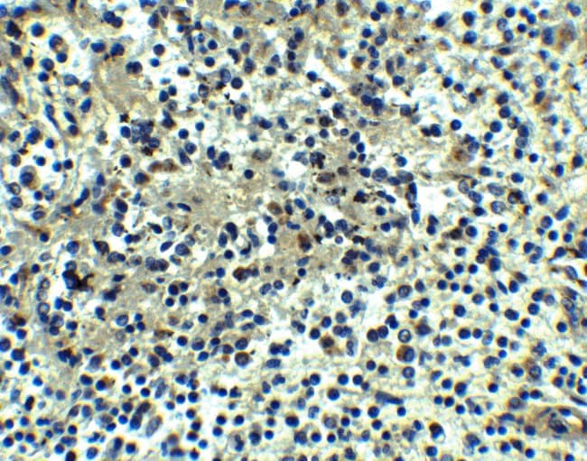 0.1MG DEPDC1B 0.1 MG