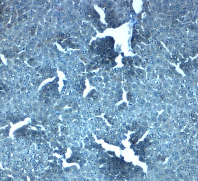0.1MG SLC38A4 0.1 MG