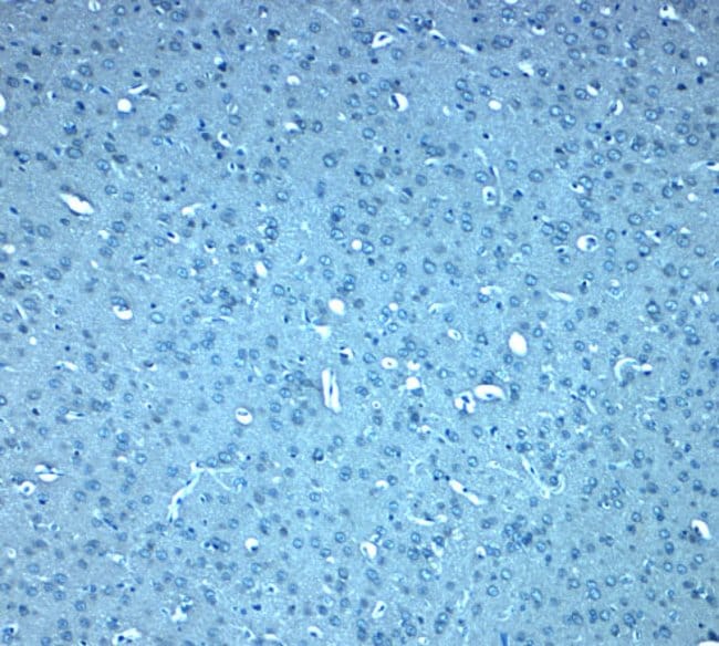 0.1MG DIS3L2 0.1 MG