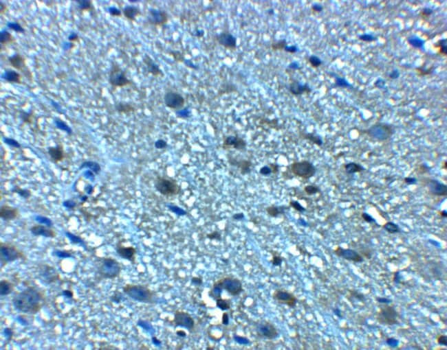 0.1MG LANCL2 0.1 MG