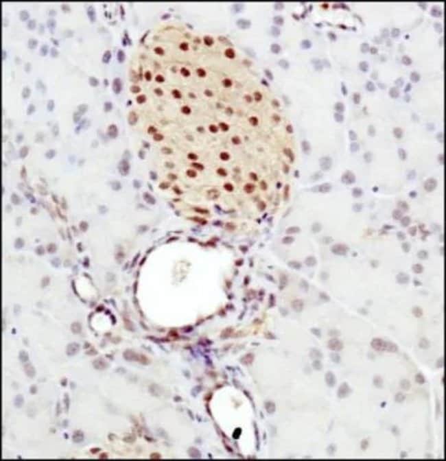 0.1MG BHLH3 0.1 MG