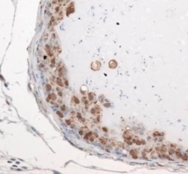 0.1ML PMSCL1 0.1 ML