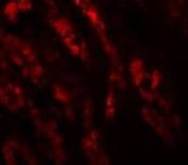 0.1MG GLS2 0.1 MG