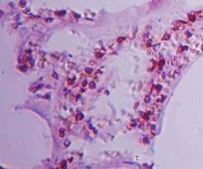 0.1MG CLEC1A 0.1 MG