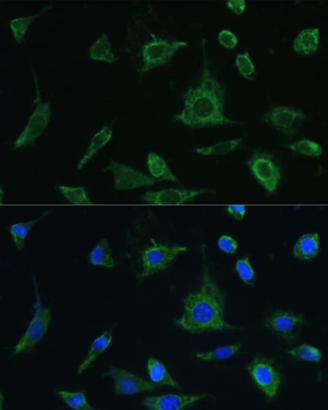 100 UL Oncostatin M Polyclonal Antibody