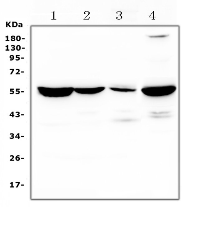 100UG ADENYLOSUCCINATE LYASE 100 UG