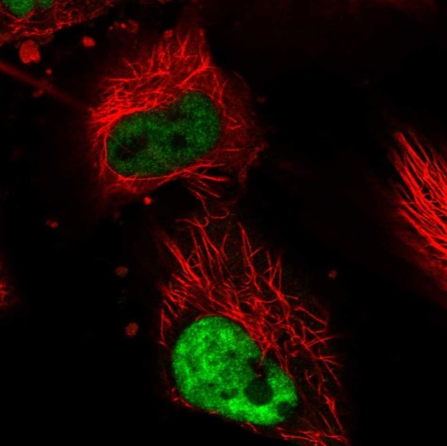 100 UL DDX5 Polyclonal Antibody