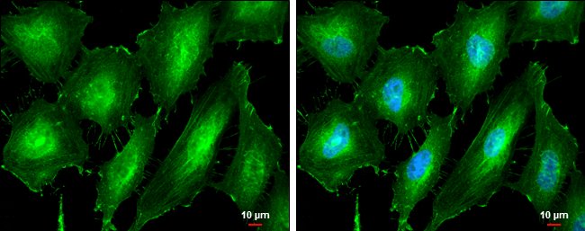 100 UL PKC ALPHA ANTIBODY