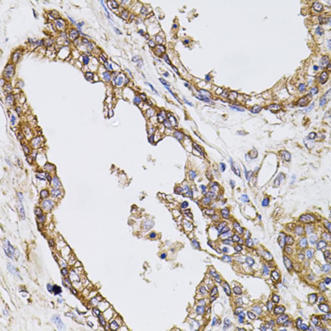 100UL CALPASTATIN ANTIBODY 100 ul