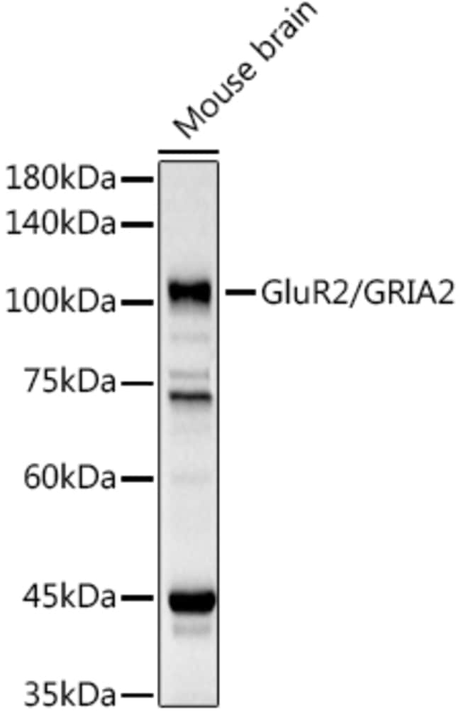 100UL GLUR2 ANTIBODY 100 ul