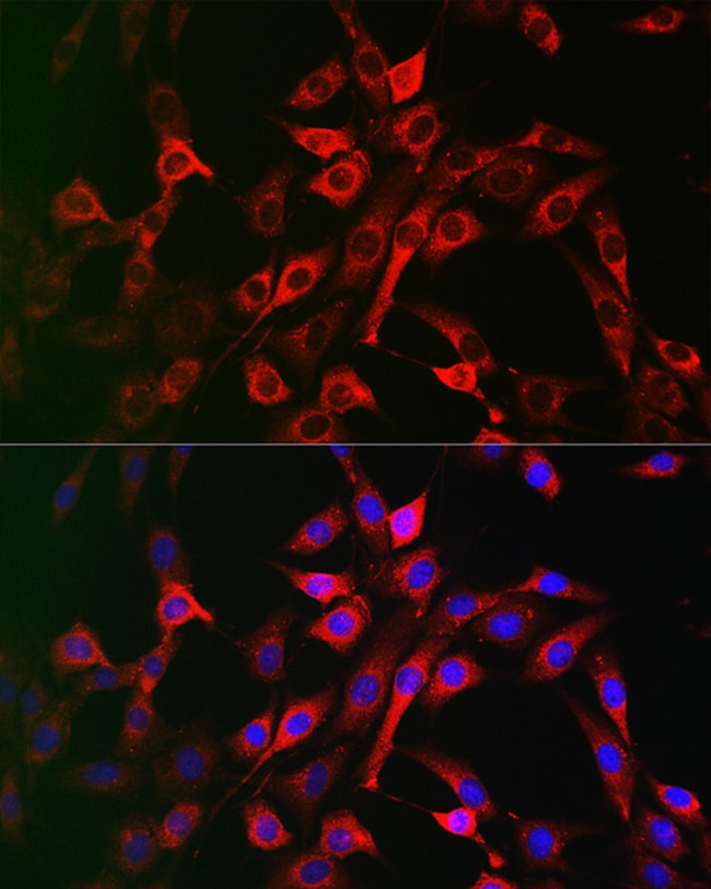 100UL LRP5 ANTIBODY 100 ul