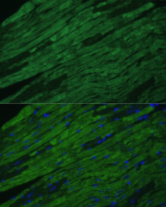 100UL CARDIAC TROPONIN I ANTIBODY 100 ul