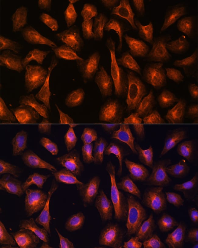 100UL ALPHA-II SPECTRIN ANTIBODY 100 ul